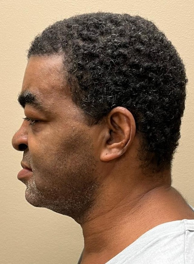 Mugshot Side